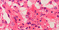 Hepatitis contagiosa canis