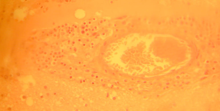 Toxoplasma gondii